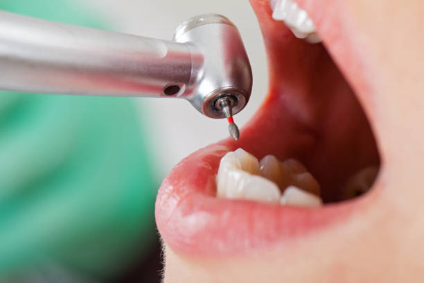 Best Broken Tooth Emergency  in Sachse, TX